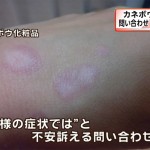 肌がまだらに白くなる